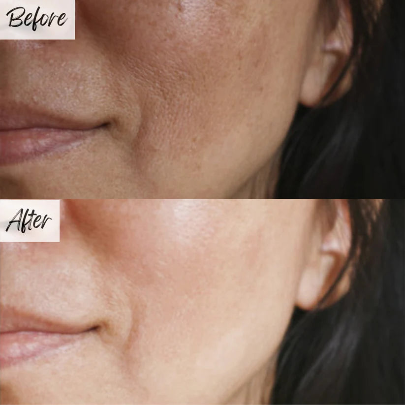 🔥last day sale🔥orange enzyme active mild body exfoliator – radiant skin with orange extract🍊🫧🍊 buy 1 get 1 free!🍊