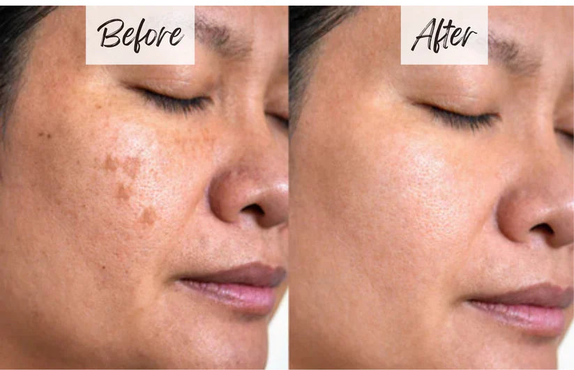 🔥last day sale🔥orange enzyme active mild body exfoliator – radiant skin with orange extract🍊🫧🍊 buy 1 get 1 free!🍊