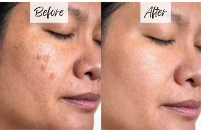 🔥LAST DAY SALE🔥Orange Enzyme Active Mild Body Exfoliator – Radiant Skin with Orange Extract🍊🫧🍊 BUY 1 GET 1 FREE!🍊