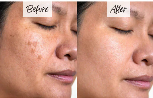 🔥LAST DAY SALE🔥Orange Enzyme Active Mild Body Exfoliator – Radiant Skin with Orange Extract🍊🫧🍊 BUY 1 GET 1 FREE!🍊